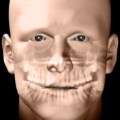 facial reconstructive surgery